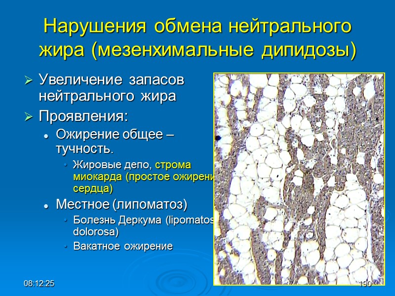 08:12:02 Нарушения обмена нейтрального жира (мезенхимальные дипидозы) Увеличение запасов нейтрального жира Проявления: Ожирение общее
